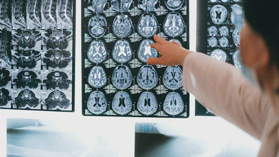 NeuroLink AI: Next-Generation Brain-Computer Interfaces featured image