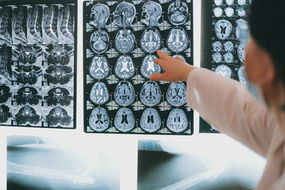 NeuroLink AI: Next-Generation Brain-Computer Interfaces featured image